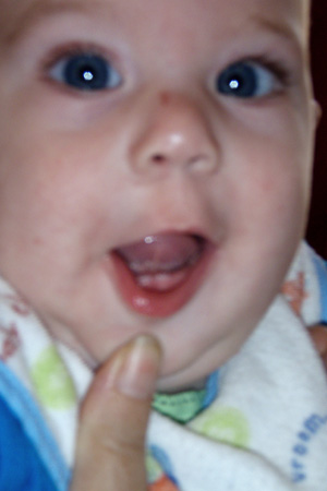 My two front teeth